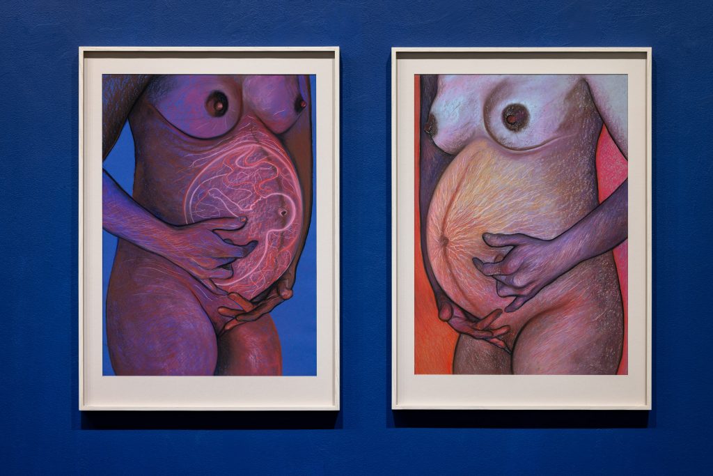 Exhibition view